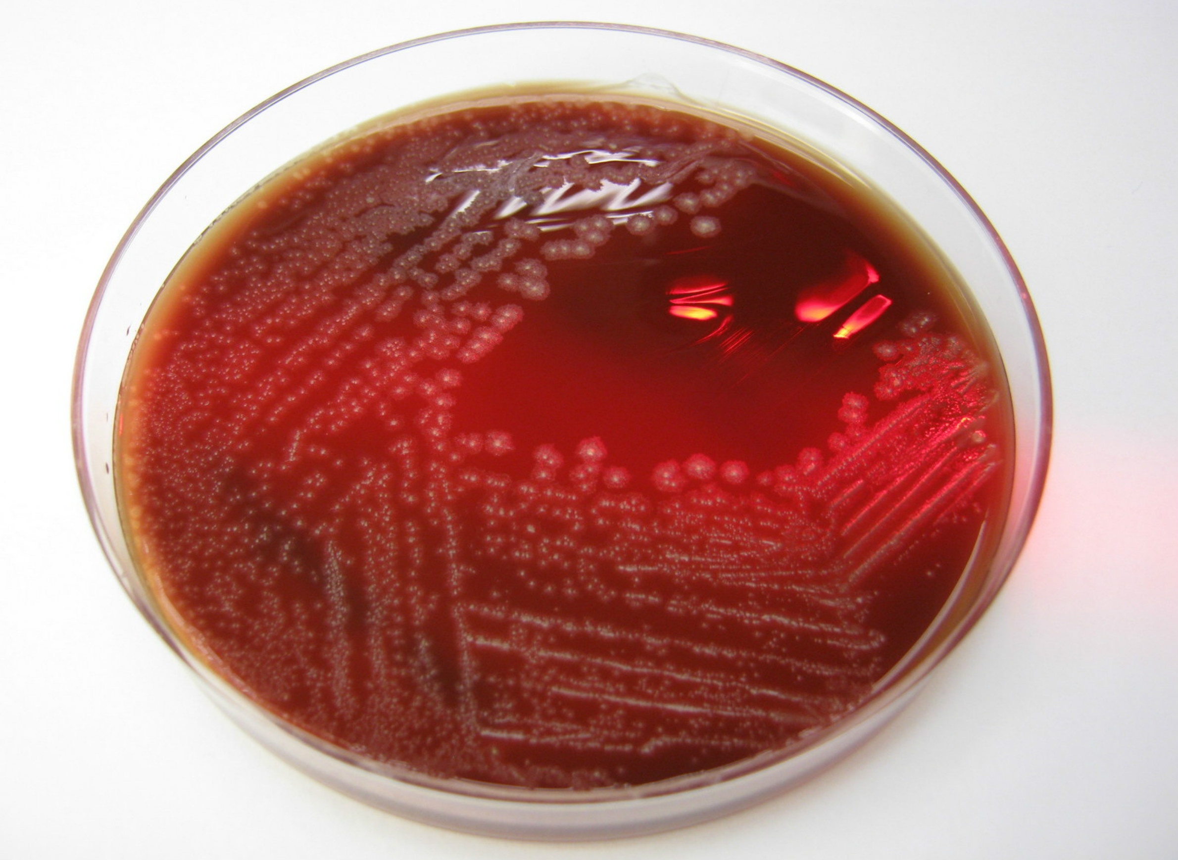 foodsafety-baking-canning-bacteria-culture-clostridiumsporogenes.jpg